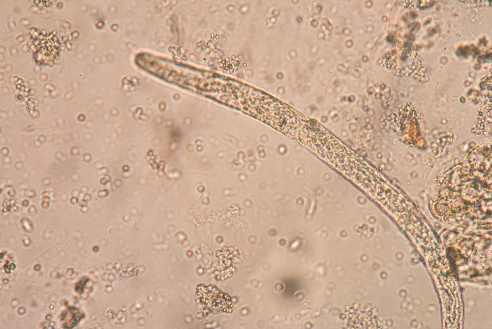 Roundworm research could reveal more about aging-related diseases.