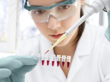 diagnostic test, AmplideX, Huntington's