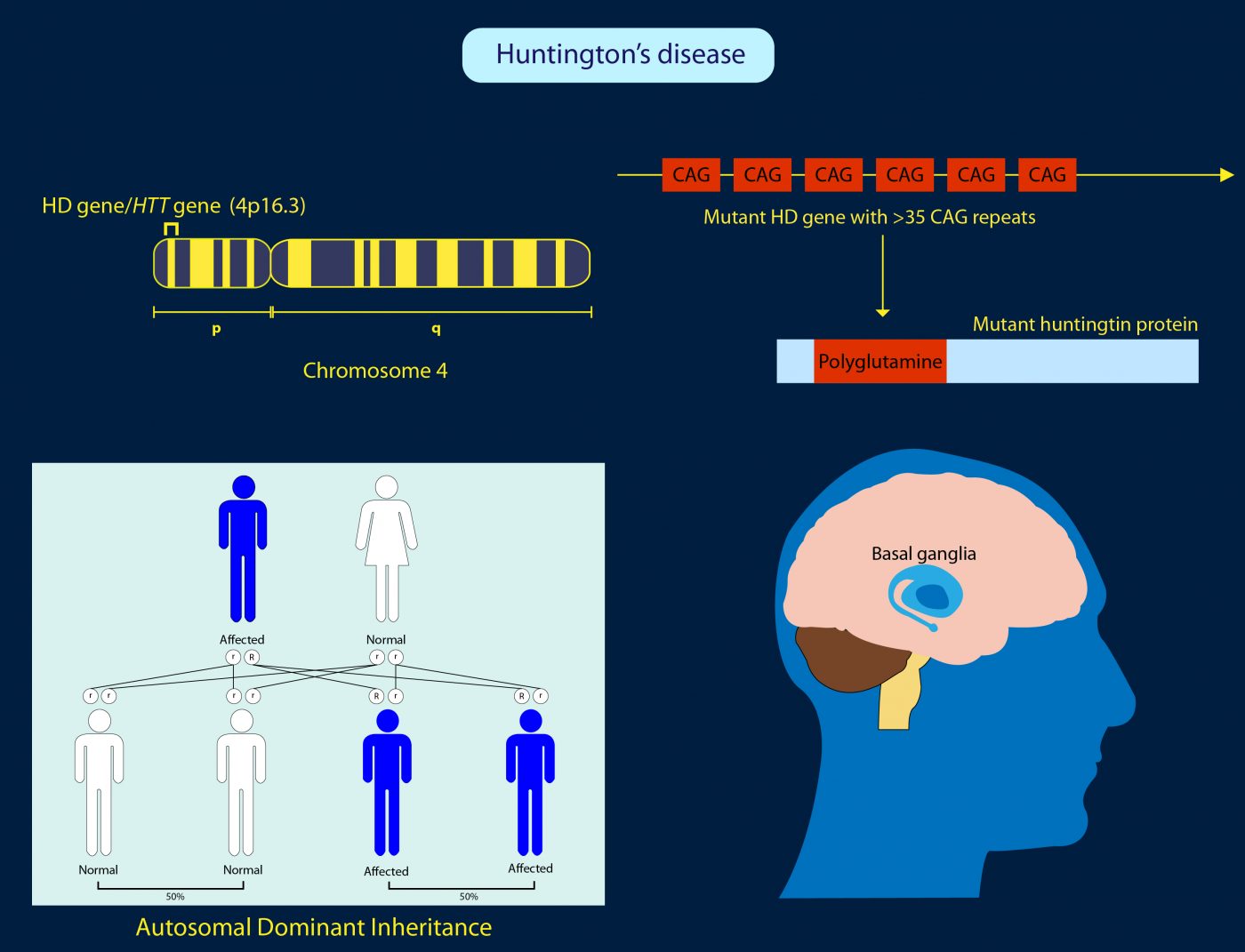 Brain Stimulation in Huntington's Disease Promising ...