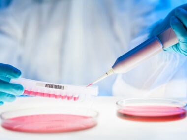 Prana Biotechnology’s experimental drug PBT2 lower tau aggregates in three-dimensional cell model of neurodegeneration.