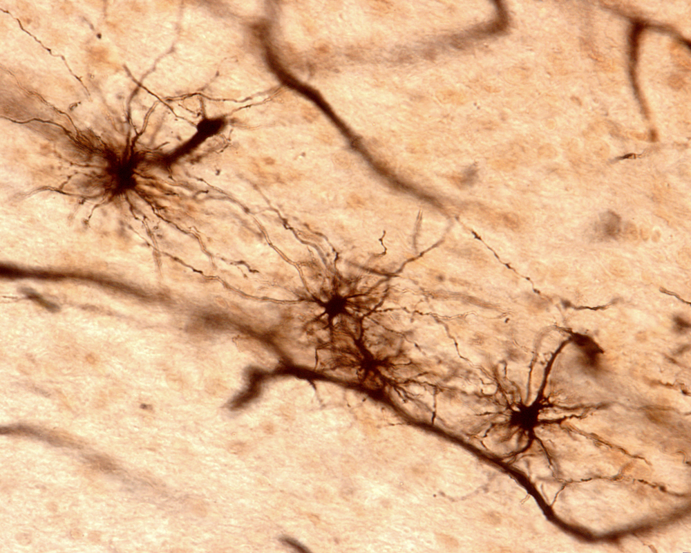 brain cells called astrocytes