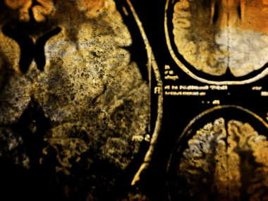 brain volume