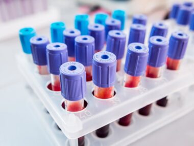 blood and disease progression