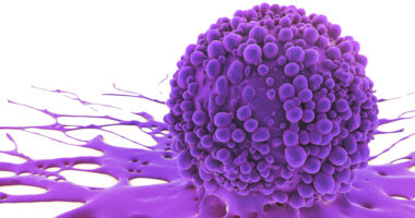 cancer cells