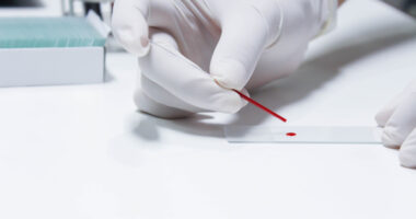 blood test, biomarkers