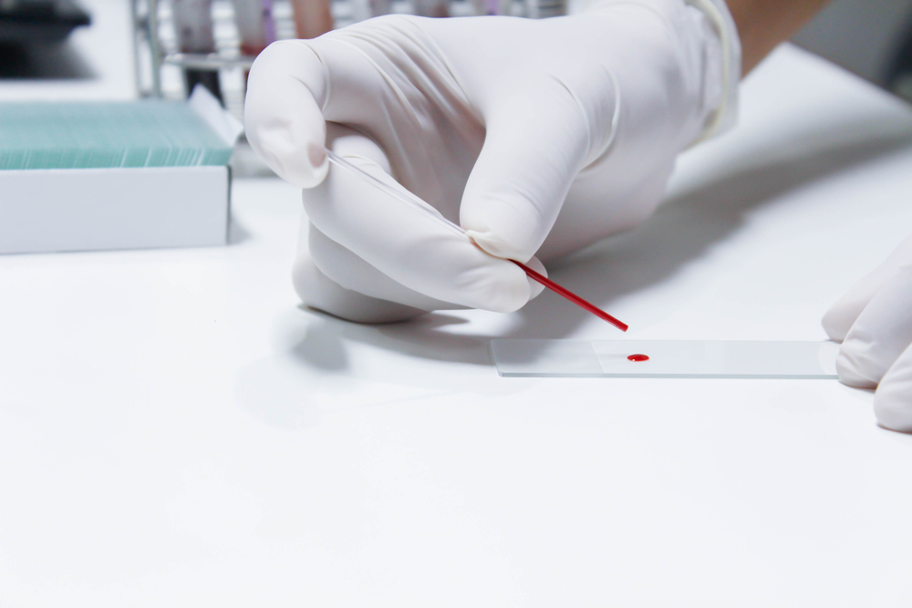 blood test, biomarkers