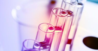 PDYN-derived Peptides, disease biomarkers