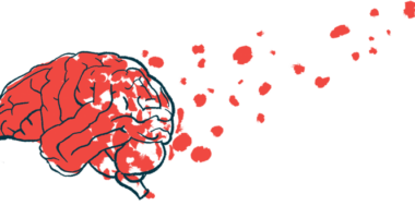 gray matter volume | Huntington's Disease News | Quality of Life Research | illustration of brain