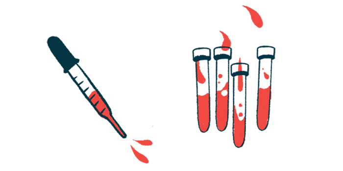 A dropper of blood hovers next to four vials.