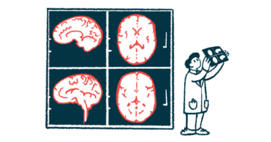 A clinician holds up an imaging scan alongside four giant images of the human brain shown on a wall.