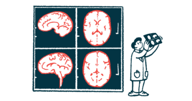 A clinician holds up an imaging scan alongside four giant images of the human brain shown on a wall.