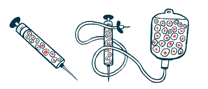 An infusion IV drip and injection needle are tools used to administer stem cell therapy.