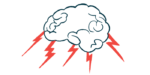 An illustration shows lightning bolts emanating from a brain.